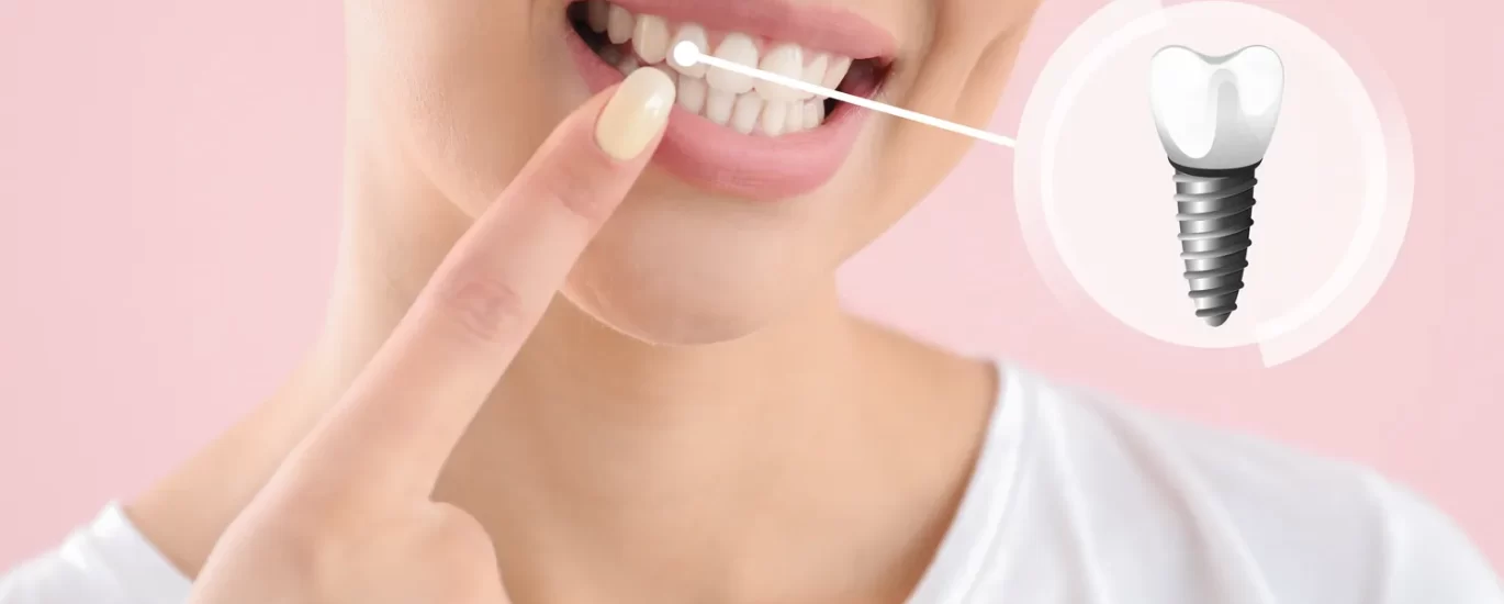 Dentysta Szczecin implanty