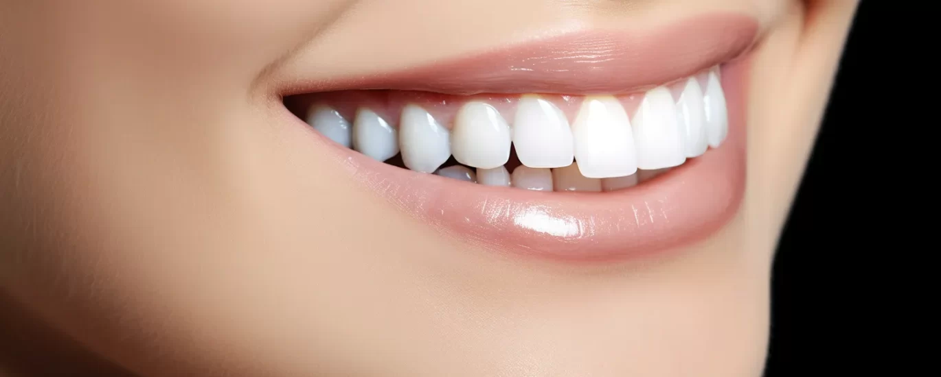 Zęby licówki